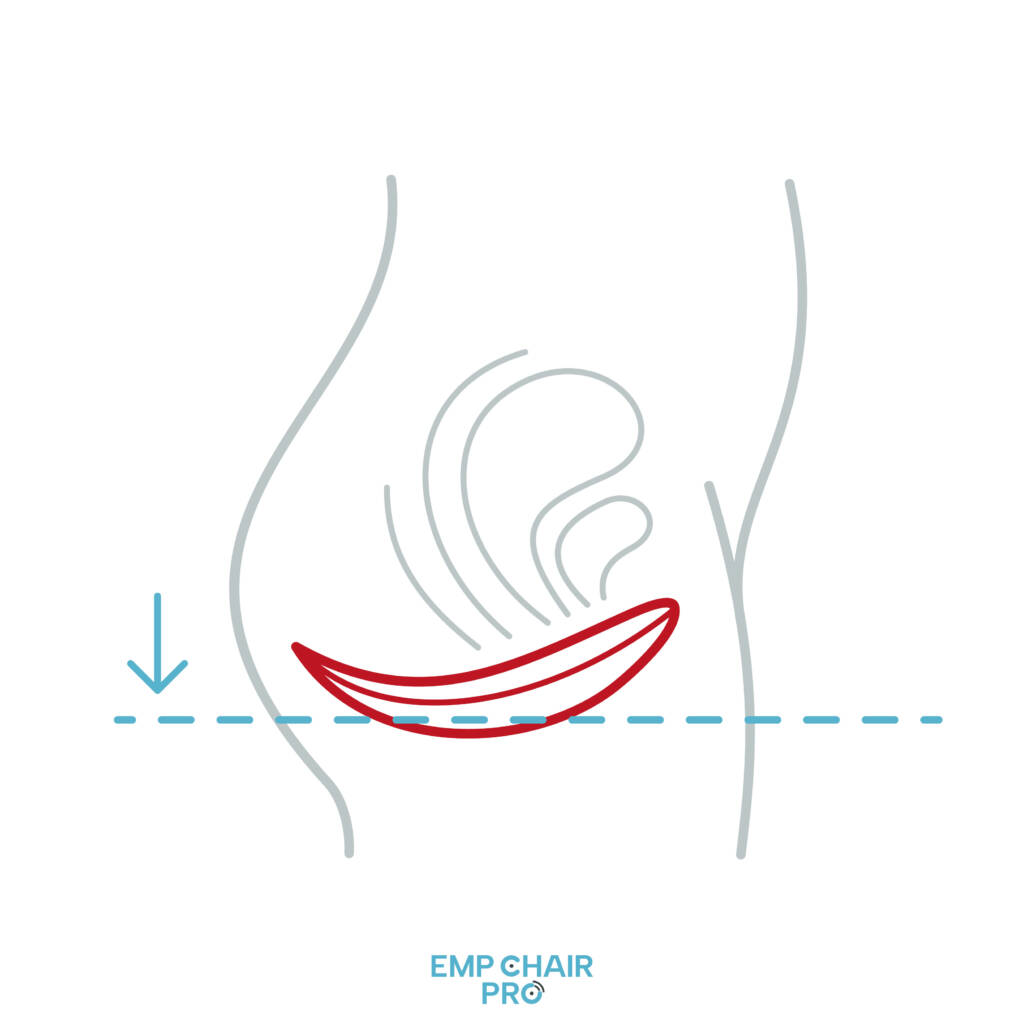 241112_EMP_Chair_Pro_Illustration_Beckenboden_Frau_01