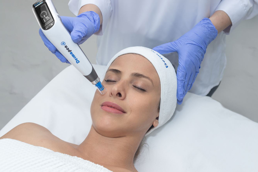 Microneedling